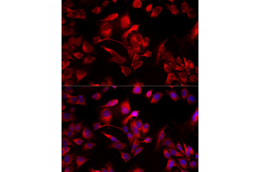 Immunofluorescence - Anti-MIRO1 Antibody (A309670) - Antibodies.com