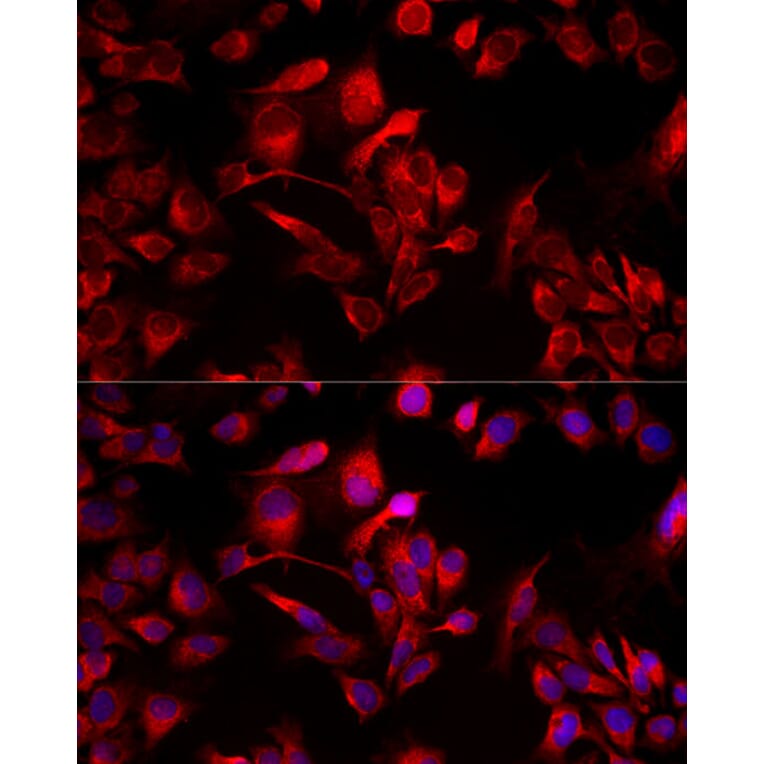 Immunofluorescence - Anti-MIRO1 Antibody (A309670) - Antibodies.com