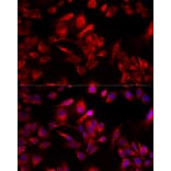 Immunofluorescence - Anti-MIRO1 Antibody (A309670) - Antibodies.com