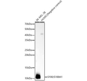 Western Blot - Anti-S100 alpha Antibody [ARC59163] (A309671) - Antibodies.com