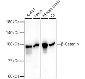 Western Blot - Anti-beta Catenin Antibody [AMC0440] (A309681) - Antibodies.com