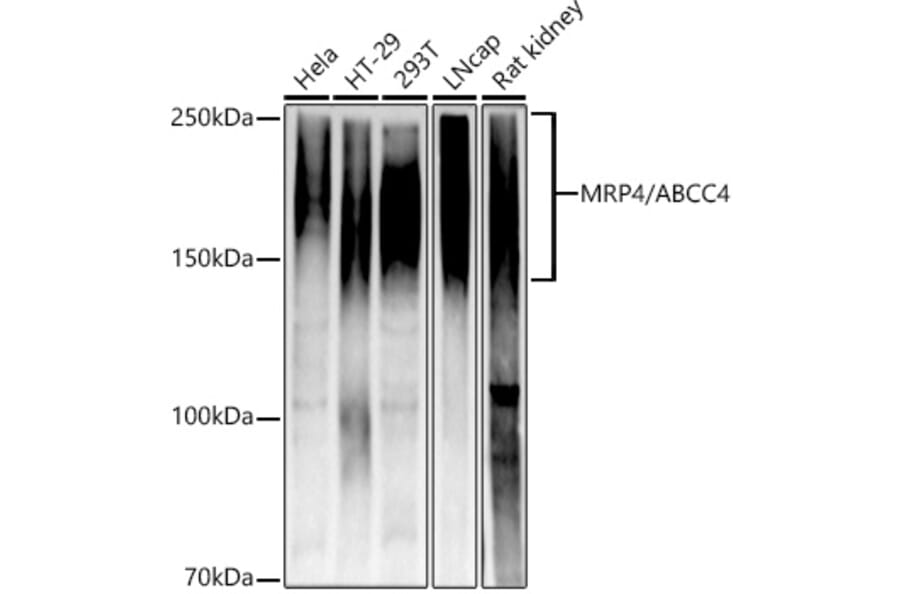 Western Blot - Anti-MRP4 Antibody [ARC52223] (A309684) - Antibodies.com