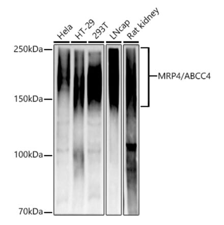 Western Blot - Anti-MRP4 Antibody [ARC52223] (A309684) - Antibodies.com