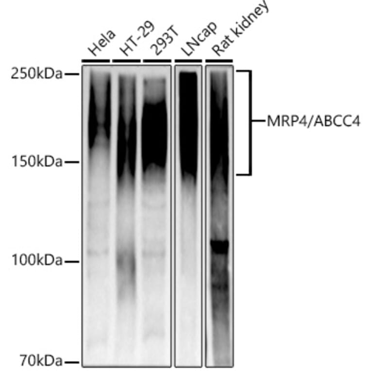 Western Blot - Anti-MRP4 Antibody [ARC52223] (A309684) - Antibodies.com