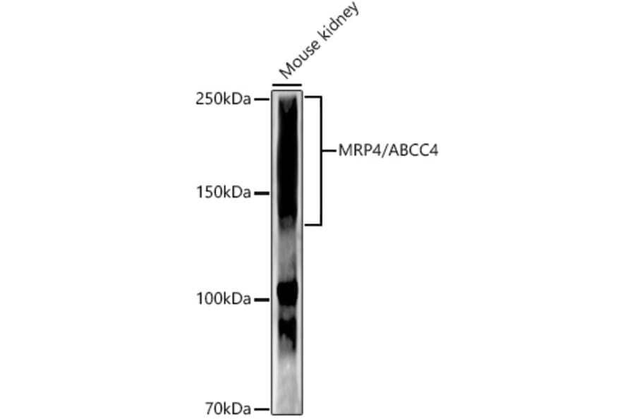 Western Blot - Anti-MRP4 Antibody [ARC52223] (A309684) - Antibodies.com