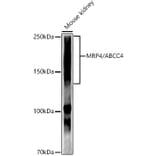Western Blot - Anti-MRP4 Antibody [ARC52223] (A309684) - Antibodies.com