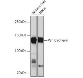 Western Blot - Anti-pan Cadherin Antibody [ARC1135] (A309685) - Antibodies.com