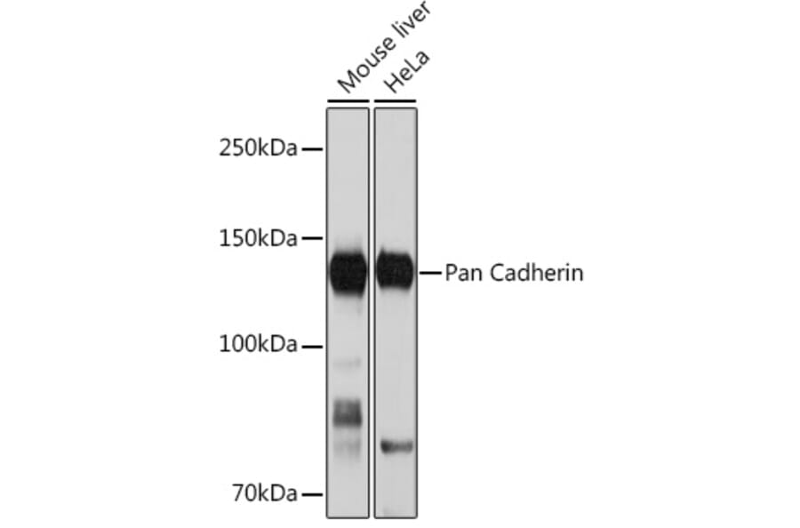 Western Blot - Anti-pan Cadherin Antibody [ARC1135] (A309685) - Antibodies.com
