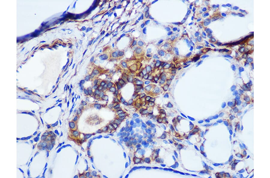 Immunohistochemistry - Anti-pan Cadherin Antibody [ARC1135] (A309685) - Antibodies.com