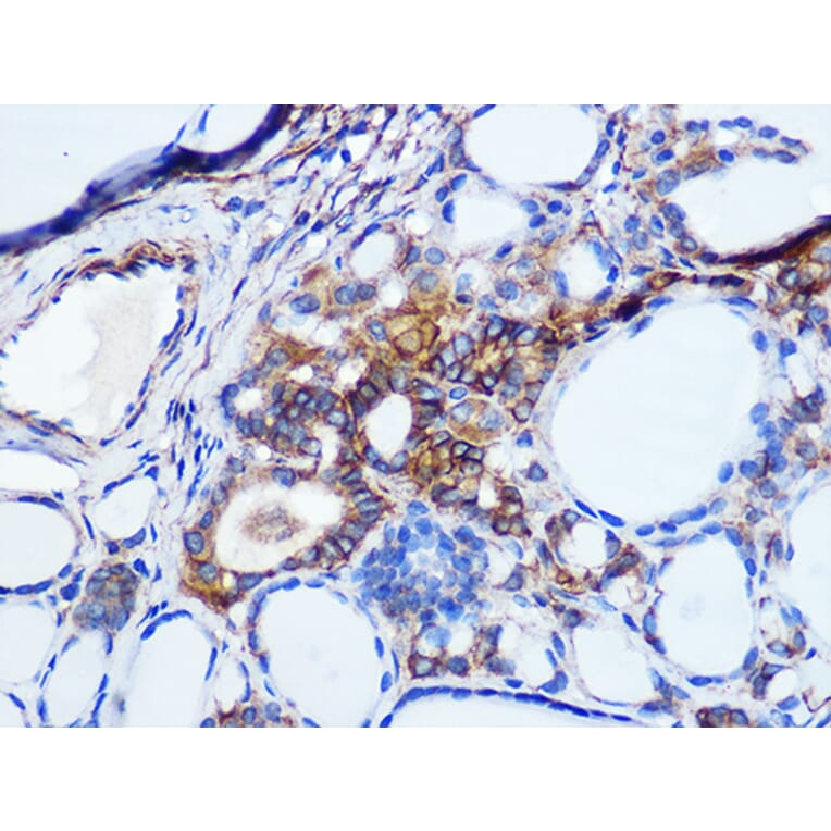 Immunohistochemistry - Anti-pan Cadherin Antibody [ARC1135] (A309685) - Antibodies.com