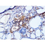 Immunohistochemistry - Anti-pan Cadherin Antibody [ARC1135] (A309685) - Antibodies.com