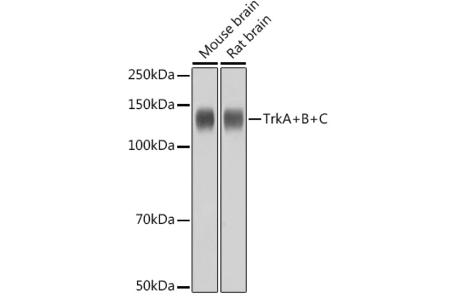 Western Blot - Anti-TrkA +TRkB + TrkC Antibody [ARC2649] (A309687) - Antibodies.com