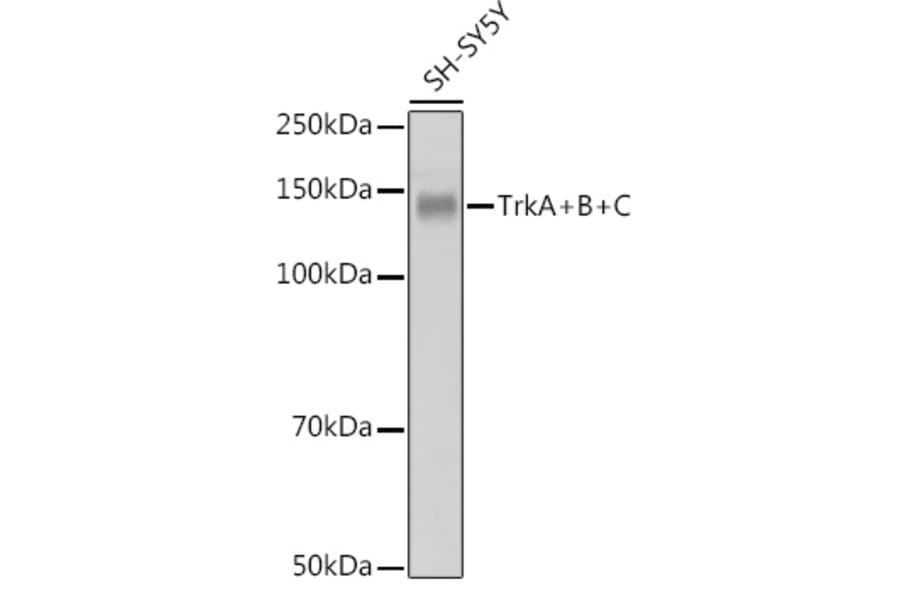 Western Blot - Anti-TrkA +TRkB + TrkC Antibody [ARC2649] (A309687) - Antibodies.com