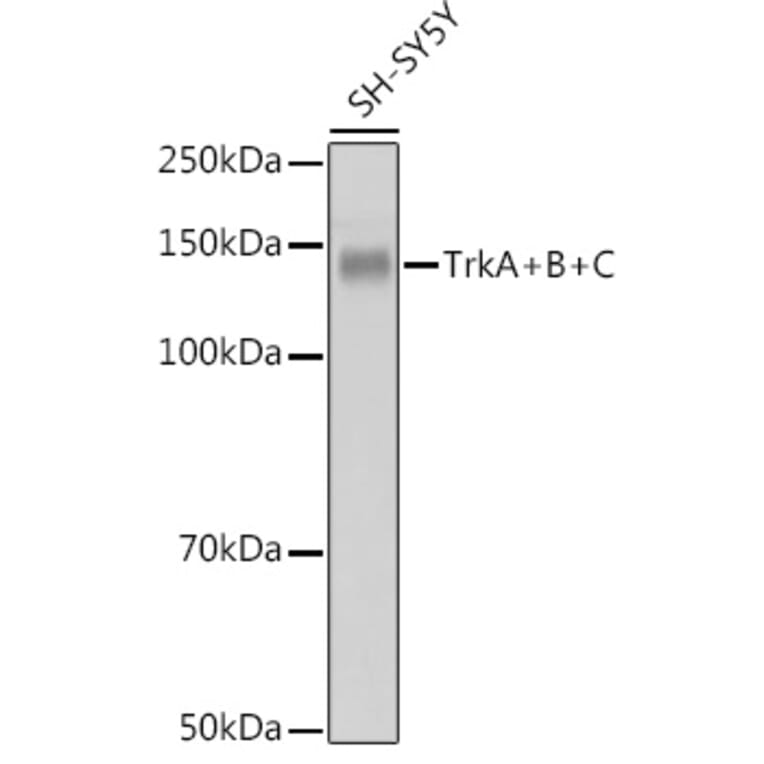 Western Blot - Anti-TrkA +TRkB + TrkC Antibody [ARC2649] (A309687) - Antibodies.com