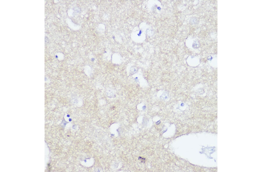 Immunohistochemistry - Anti-TrkA +TRkB + TrkC Antibody [ARC2649] (A309687) - Antibodies.com