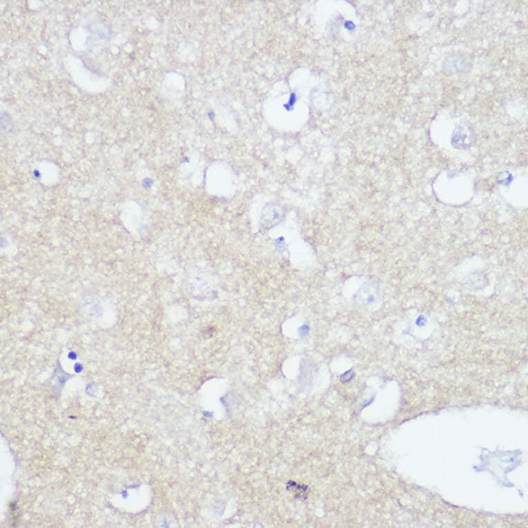 Immunohistochemistry - Anti-TrkA +TRkB + TrkC Antibody [ARC2649] (A309687) - Antibodies.com