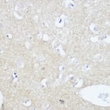 Immunohistochemistry - Anti-TrkA +TRkB + TrkC Antibody [ARC2649] (A309687) - Antibodies.com