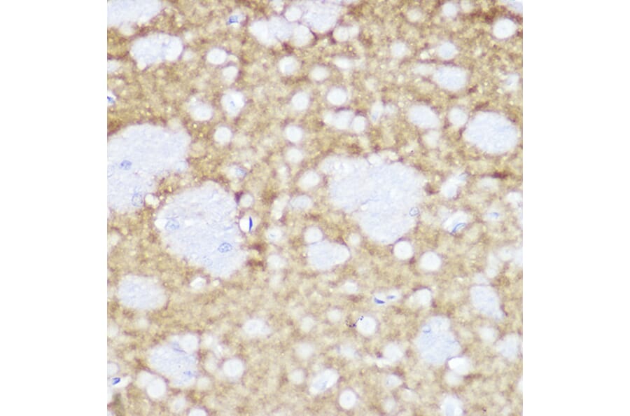 Immunohistochemistry - Anti-TrkA +TRkB + TrkC Antibody [ARC2649] (A309687) - Antibodies.com