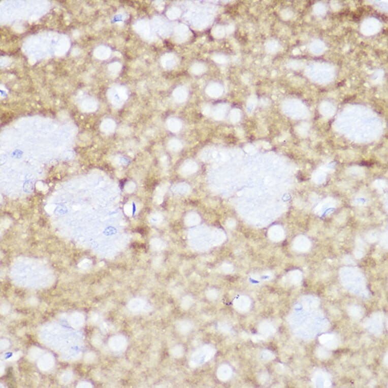 Immunohistochemistry - Anti-TrkA +TRkB + TrkC Antibody [ARC2649] (A309687) - Antibodies.com