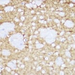 Immunohistochemistry - Anti-TrkA +TRkB + TrkC Antibody [ARC2649] (A309687) - Antibodies.com