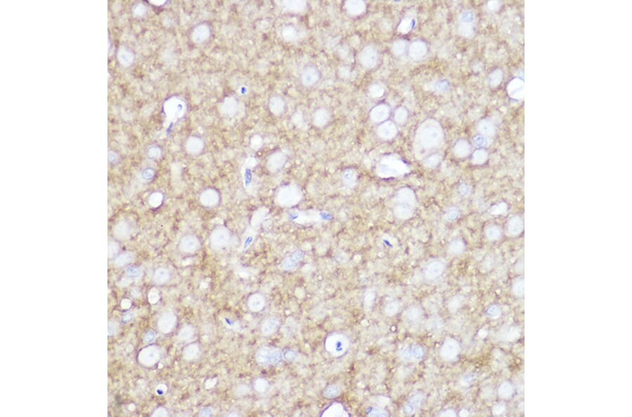 Immunohistochemistry - Anti-TrkA +TRkB + TrkC Antibody [ARC2649] (A309687) - Antibodies.com