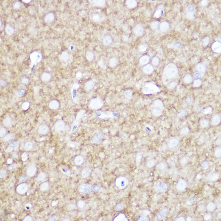 Immunohistochemistry - Anti-TrkA +TRkB + TrkC Antibody [ARC2649] (A309687) - Antibodies.com