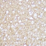 Immunohistochemistry - Anti-TrkA +TRkB + TrkC Antibody [ARC2649] (A309687) - Antibodies.com