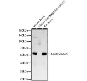 Western Blot - Anti-GAD65 Antibody [ARC58332] (A309688) - Antibodies.com