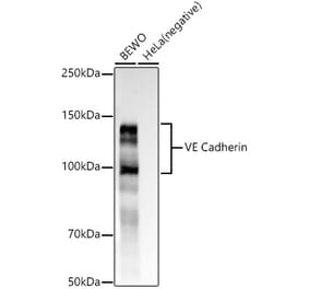 Western Blot - Anti-VE Cadherin Antibody [ARC58056] (A309692) - Antibodies.com
