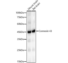 Western Blot - Anti-Connexin 43 / GJA1 Antibody [ARC58819] (A309695) - Antibodies.com