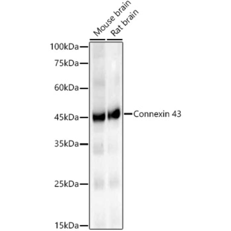 Western Blot - Anti-Connexin 43/GJA1 Antibody [ARC58819] (A309695) - Antibodies.com