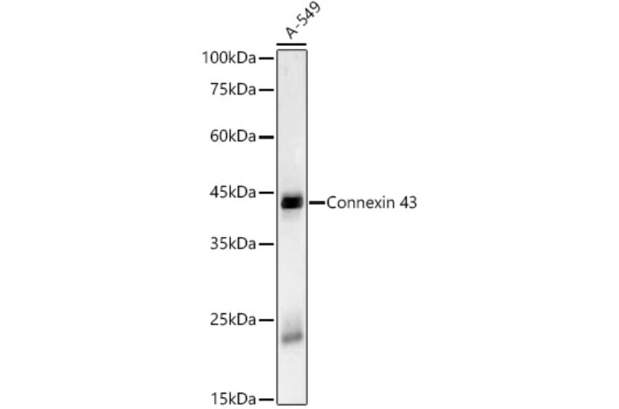 Western Blot - Anti-Connexin 43/GJA1 Antibody [ARC58819] (A309695) - Antibodies.com