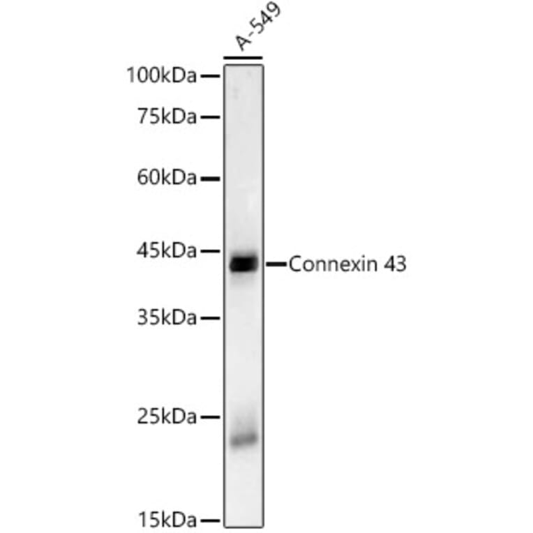 Western Blot - Anti-Connexin 43/GJA1 Antibody [ARC58819] (A309695) - Antibodies.com