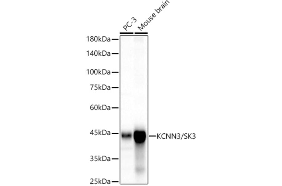 Western Blot - Anti-KCNN3/SK3 Antibody [ARC60792] (A309697) - Antibodies.com