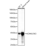 Western Blot - Anti-KCNN3/SK3 Antibody [ARC60792] (A309697) - Antibodies.com