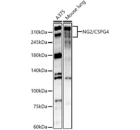 Western Blot - Anti-NG2 Antibody (A309698) - Antibodies.com