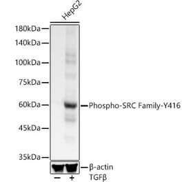 Western Blot - Anti-Src (phospho Tyr416) Antibody [ARC57736] (A309701) - Antibodies.com