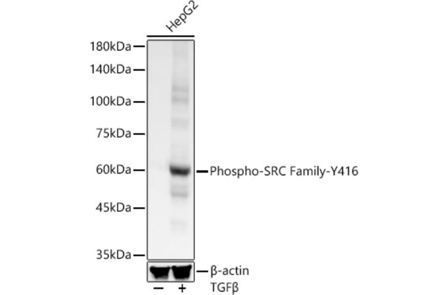 Western Blot - Anti-Src (phospho Tyr416) Antibody [ARC57736] (A309701) - Antibodies.com