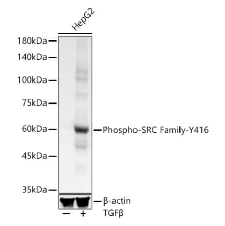 Western Blot - Anti-Src (phospho Tyr416) Antibody [ARC57736] (A309701) - Antibodies.com