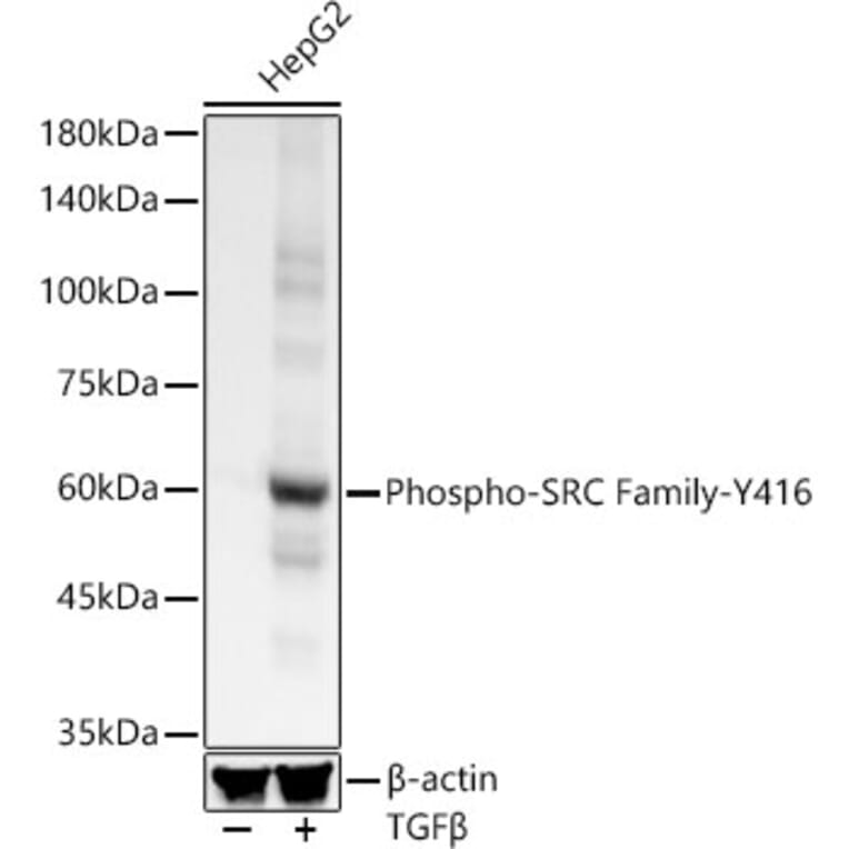 Western Blot - Anti-Src (phospho Tyr416) Antibody [ARC57736] (A309701) - Antibodies.com
