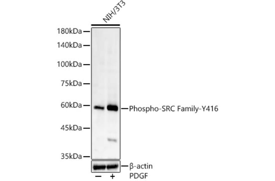 Western Blot - Anti-Src (phospho Tyr416) Antibody [ARC57736] (A309701) - Antibodies.com