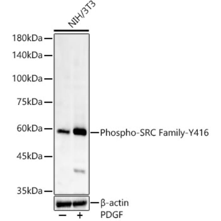 Western Blot - Anti-Src (phospho Tyr416) Antibody [ARC57736] (A309701) - Antibodies.com
