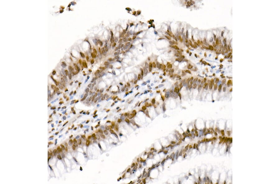Immunohistochemistry - Anti-Histone H4 (acetyl Lys5 + Lys8 + Lys12 + Lys16) Antibody (A309705) - Antibodies.com