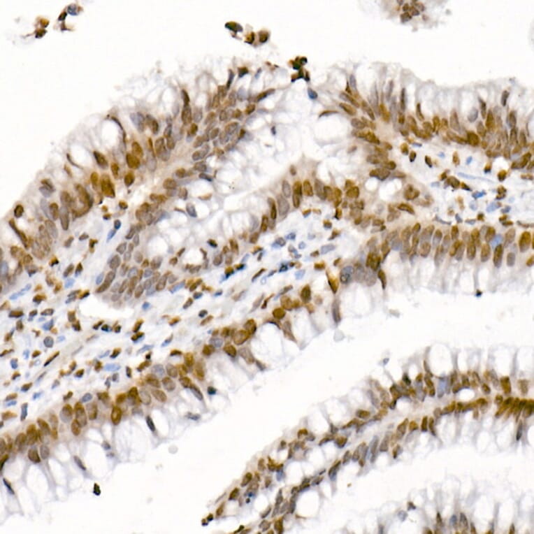 Immunohistochemistry - Anti-Histone H4 (acetyl Lys5 + Lys8 + Lys12 + Lys16) Antibody (A309705) - Antibodies.com