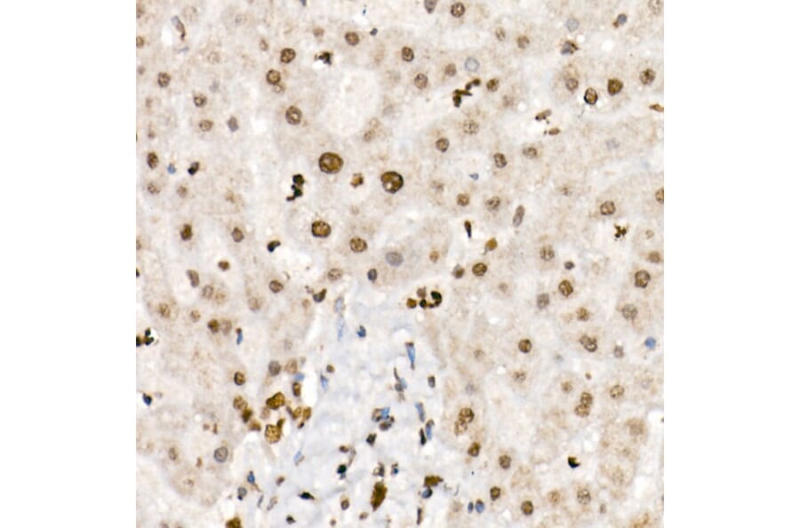 Immunohistochemistry - Anti-Histone H4 (acetyl Lys5 + Lys8 + Lys12 + Lys16) Antibody (A309705) - Antibodies.com
