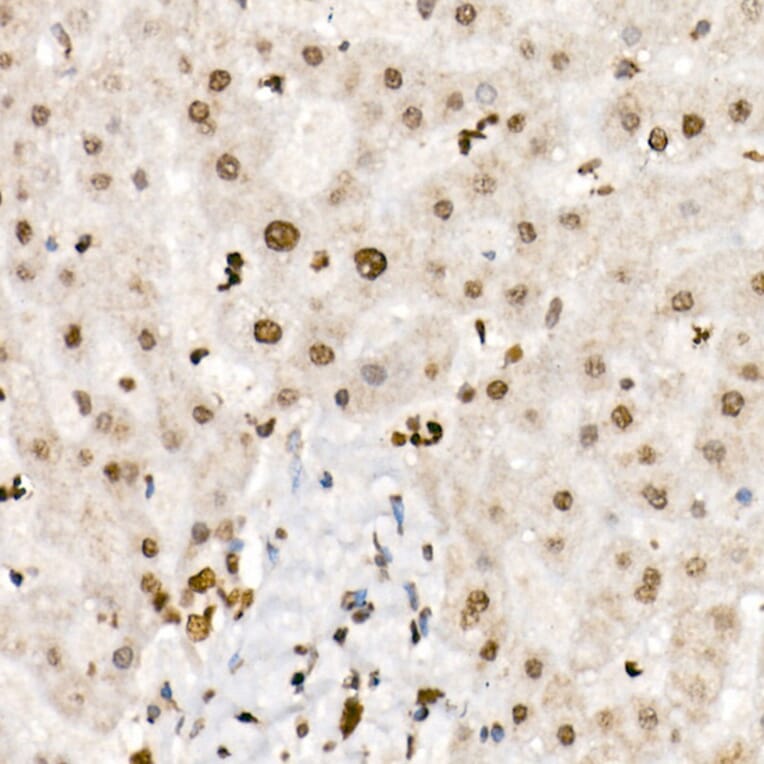 Immunohistochemistry - Anti-Histone H4 (acetyl Lys5 + Lys8 + Lys12 + Lys16) Antibody (A309705) - Antibodies.com