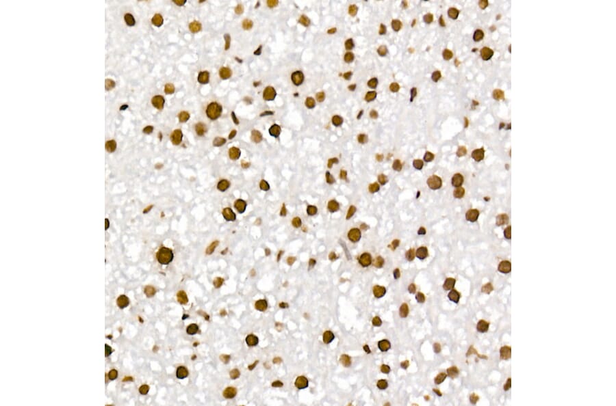 Immunohistochemistry - Anti-Histone H4 (acetyl Lys5 + Lys8 + Lys12 + Lys16) Antibody (A309705) - Antibodies.com