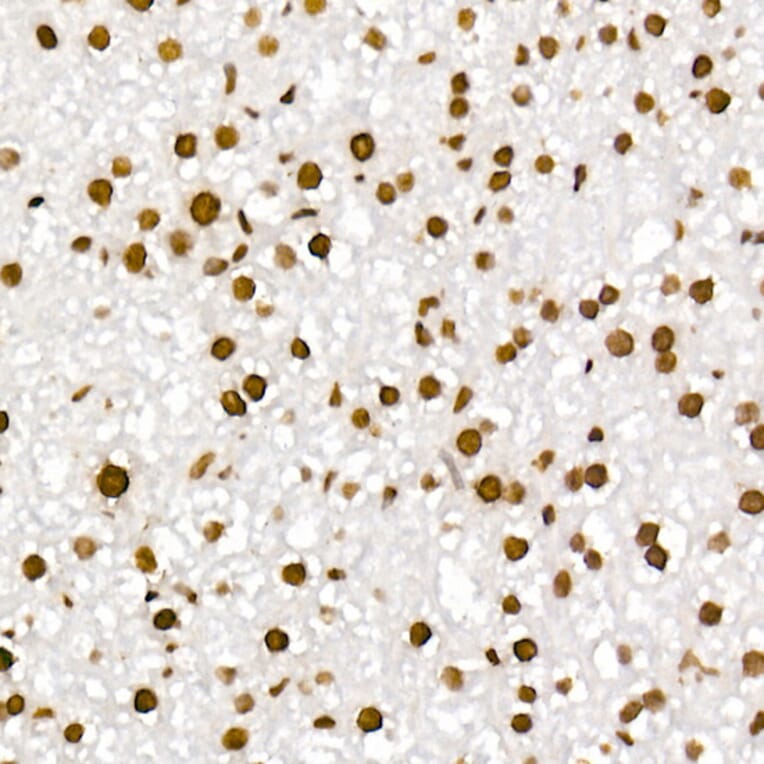 Immunohistochemistry - Anti-Histone H4 (acetyl Lys5 + Lys8 + Lys12 + Lys16) Antibody (A309705) - Antibodies.com