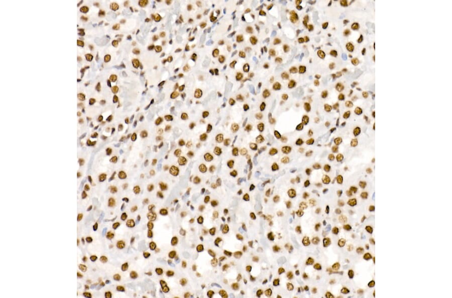 Immunohistochemistry - Anti-Histone H4 (acetyl Lys5 + Lys8 + Lys12 + Lys16) Antibody (A309705) - Antibodies.com