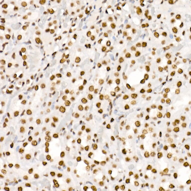 Immunohistochemistry - Anti-Histone H4 (acetyl Lys5 + Lys8 + Lys12 + Lys16) Antibody (A309705) - Antibodies.com